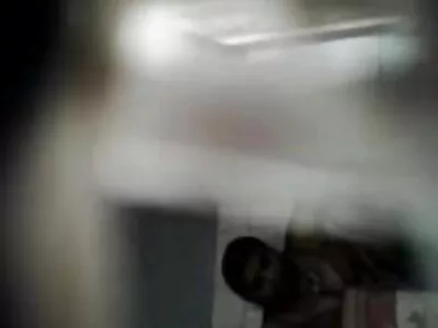 Blokes rakhål slog med ett köttverktyg